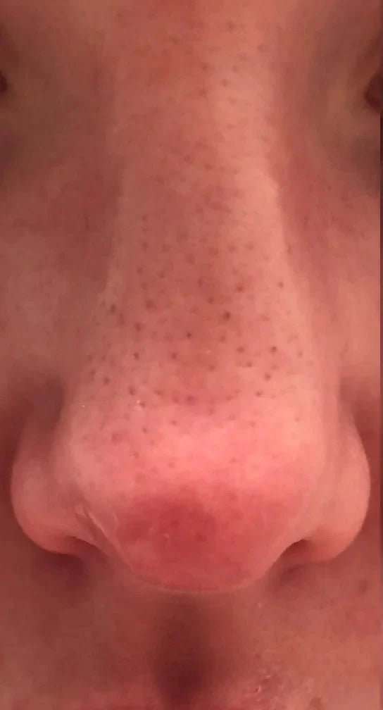 Before image