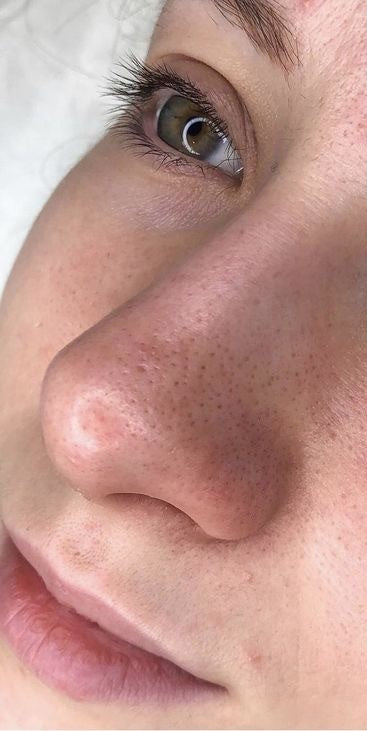 Before image